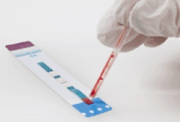 Image: The Determine HIV-1/2 Ag/Ab Combo test (Photo courtesy of Alere).